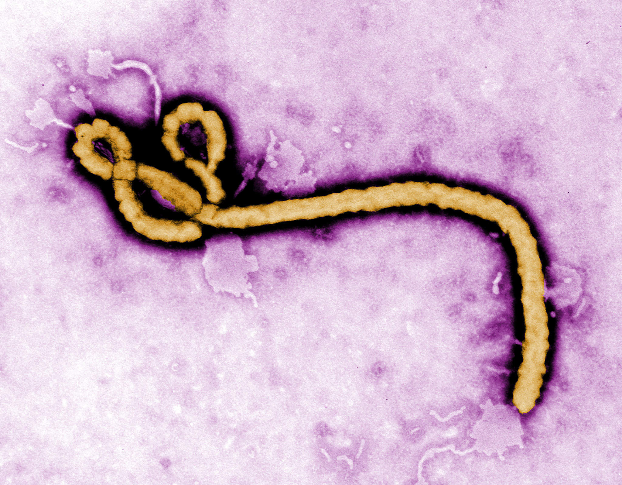 Immigration Restrictionists Exploit Ebola Tragedy